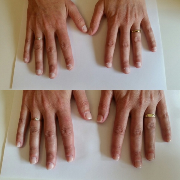 Gemiddelde nagelbijter SvD voor en na.jpg